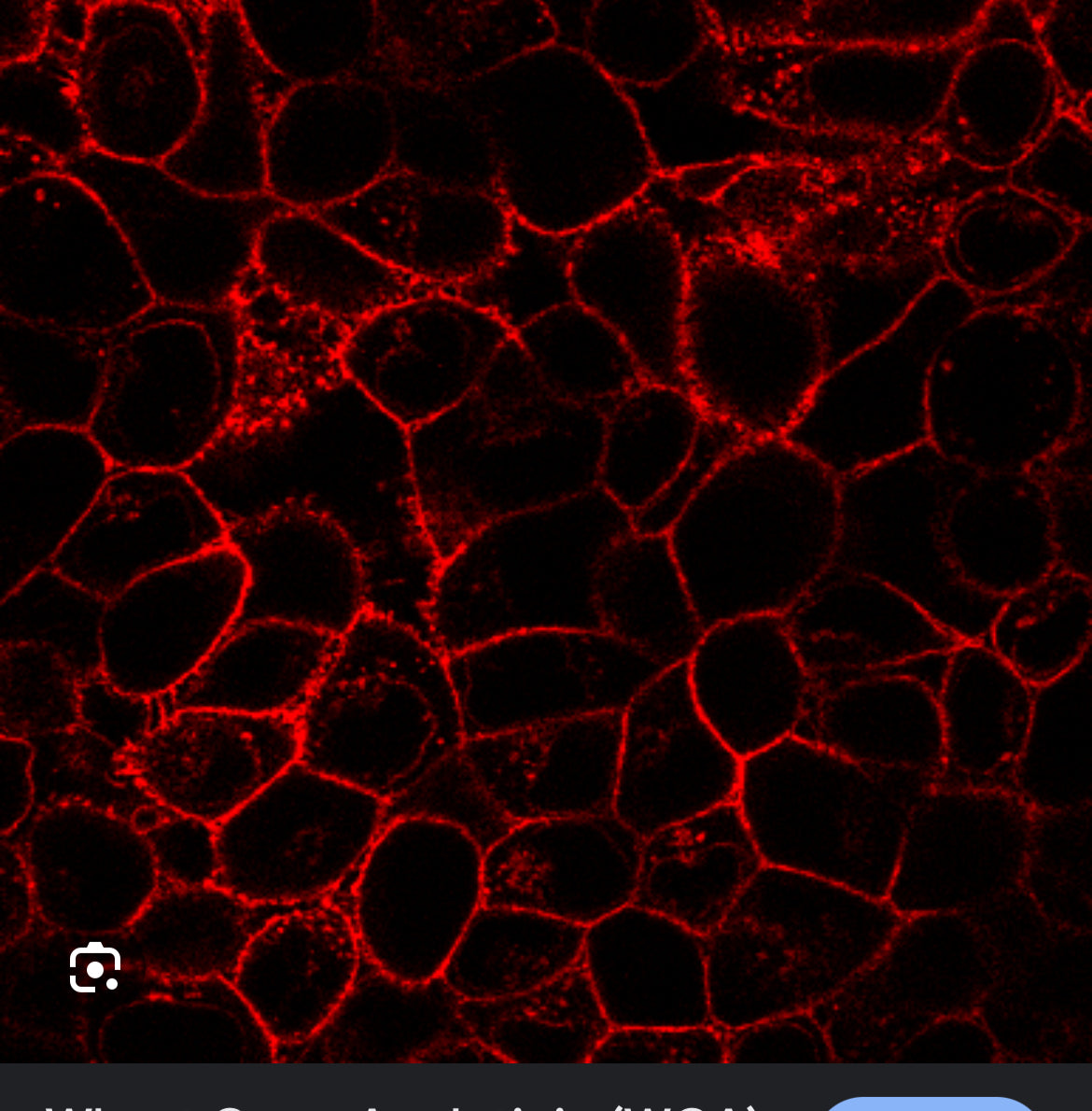 Intro to Neurodegeneration – Module 1